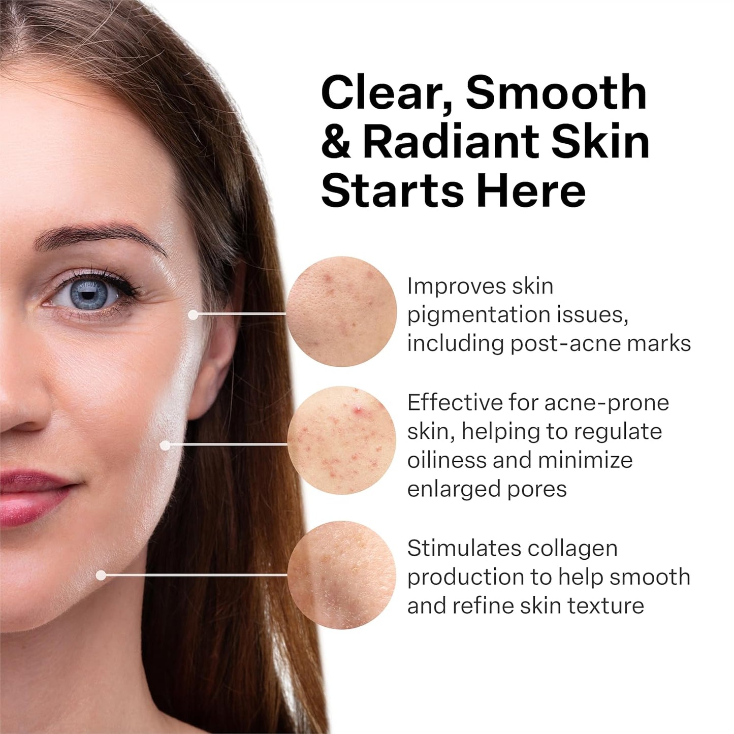 French Pharmacy Vitamin A (Retinoids) Lightweight Face Cream for Anti-Aging, Reduce Wrinkles, Prevents Acne Breakouts, and Hyperpigmentation - Skincare for Smooth, Radiant Skin - 50g Cream