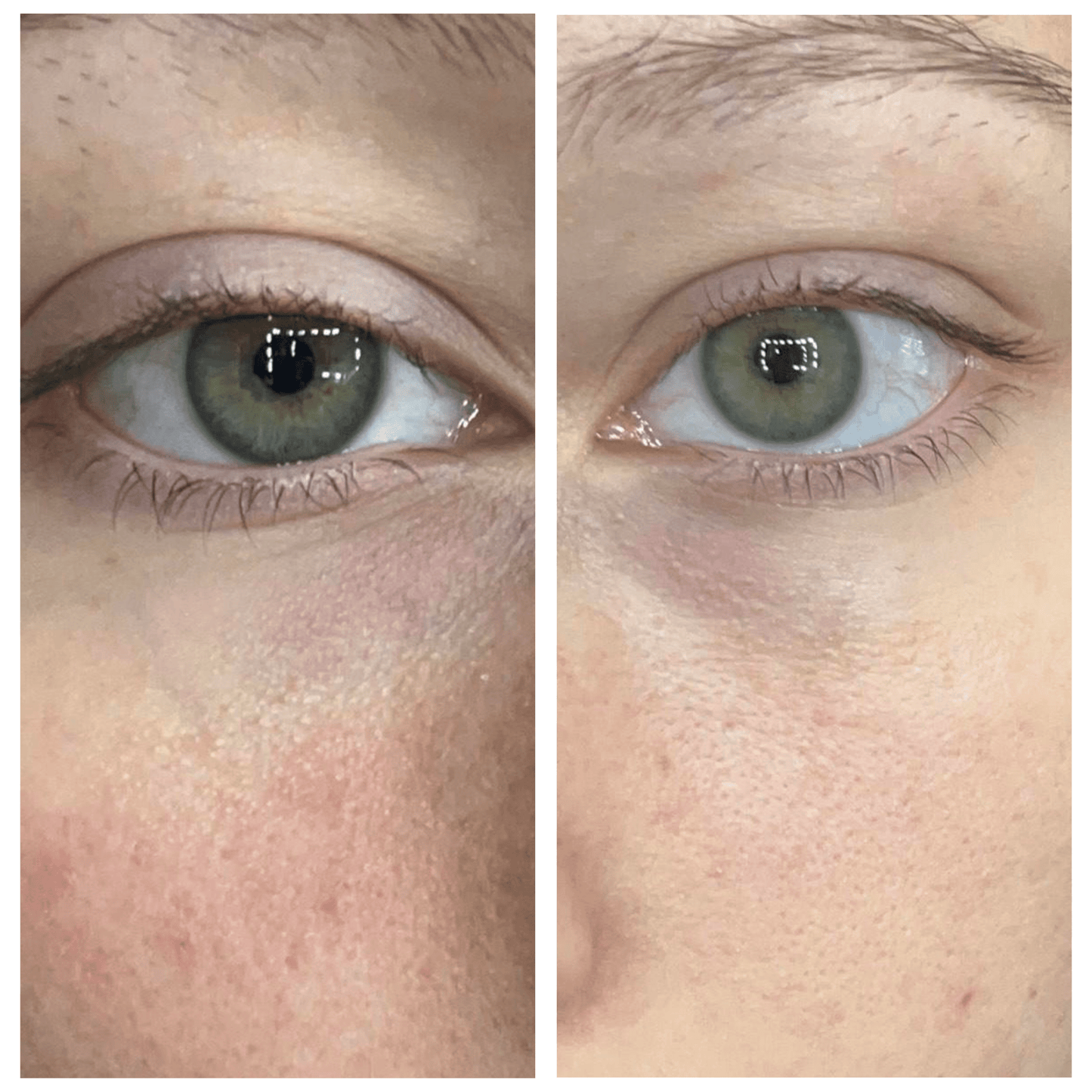 Caffeine Eye Cream