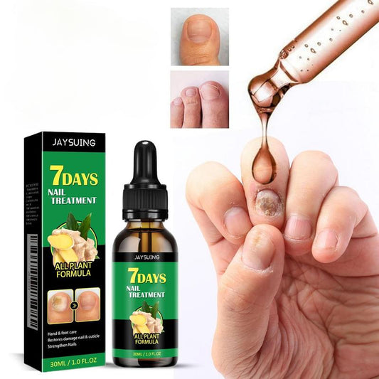 Ginger Nail Treatment, Support Nail Care,   Ginger Cuticle Care Oil for Nails,Cuticle Serum for Nails Comfort Manicure