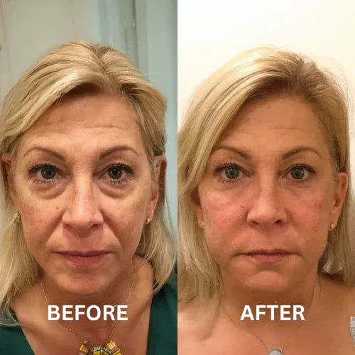 Insta Firm – Instant Eye & Lid Lift