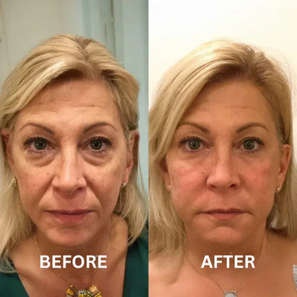 Insta Firm – Instant Eye & Lid Lift