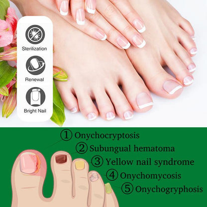Ginger Nail Treatment, Support Nail Care,   Ginger Cuticle Care Oil for Nails,Cuticle Serum for Nails Comfort Manicure